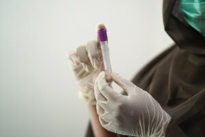 中高生がワキガの手術をするべきかどうかの判断基準は？